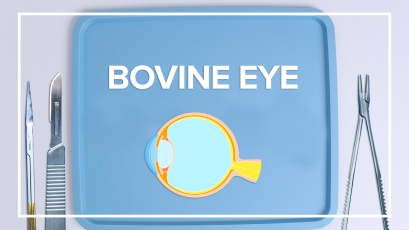 Bovine Eye thumbnail image